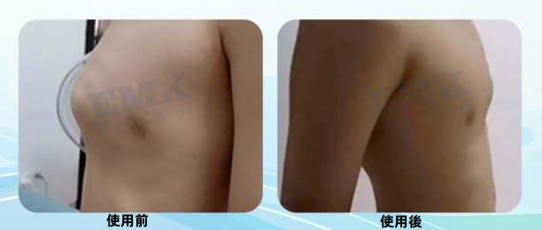 1773209571977876.png acb29391-1094-4d8f-bec8-6b9d39e6140b_副本.png