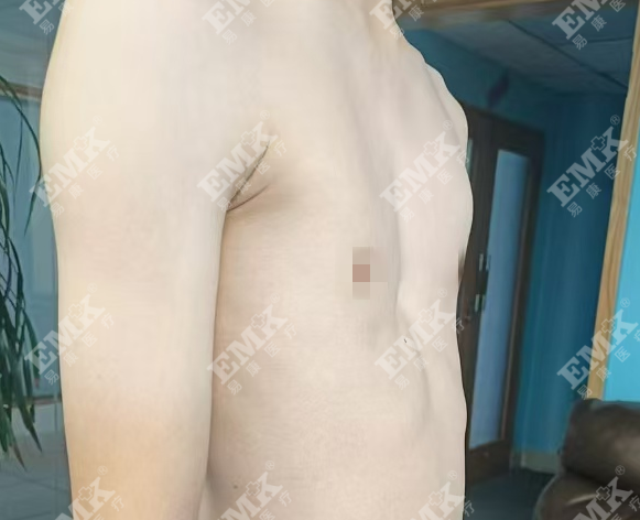 1774332529738216.png 2024-08-30使用前_副本.png