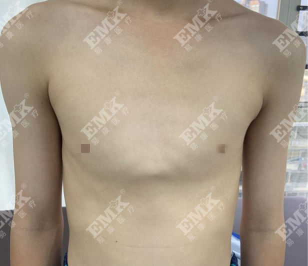 1774339287520447.png 2025-07-23使用前_副本.png